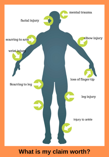 Dog Bite Case Studies - Claim for Dogbite